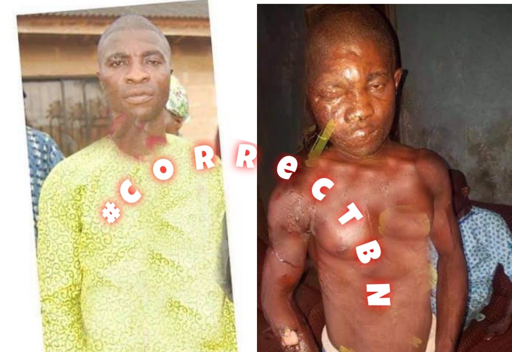 SCARING PHOTOS of Peacemaker set ablaze while trying to settle a dispute between friends in Ondo
