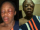 Voice over artist attacked by one-chance operators in Ikeja (Photos)