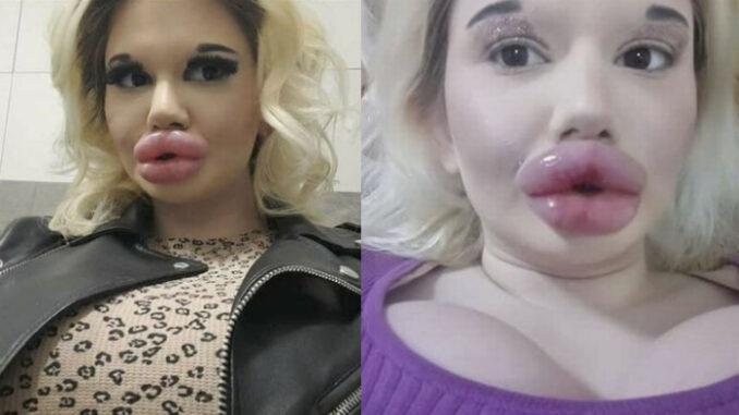 Student with the 'biggest lips